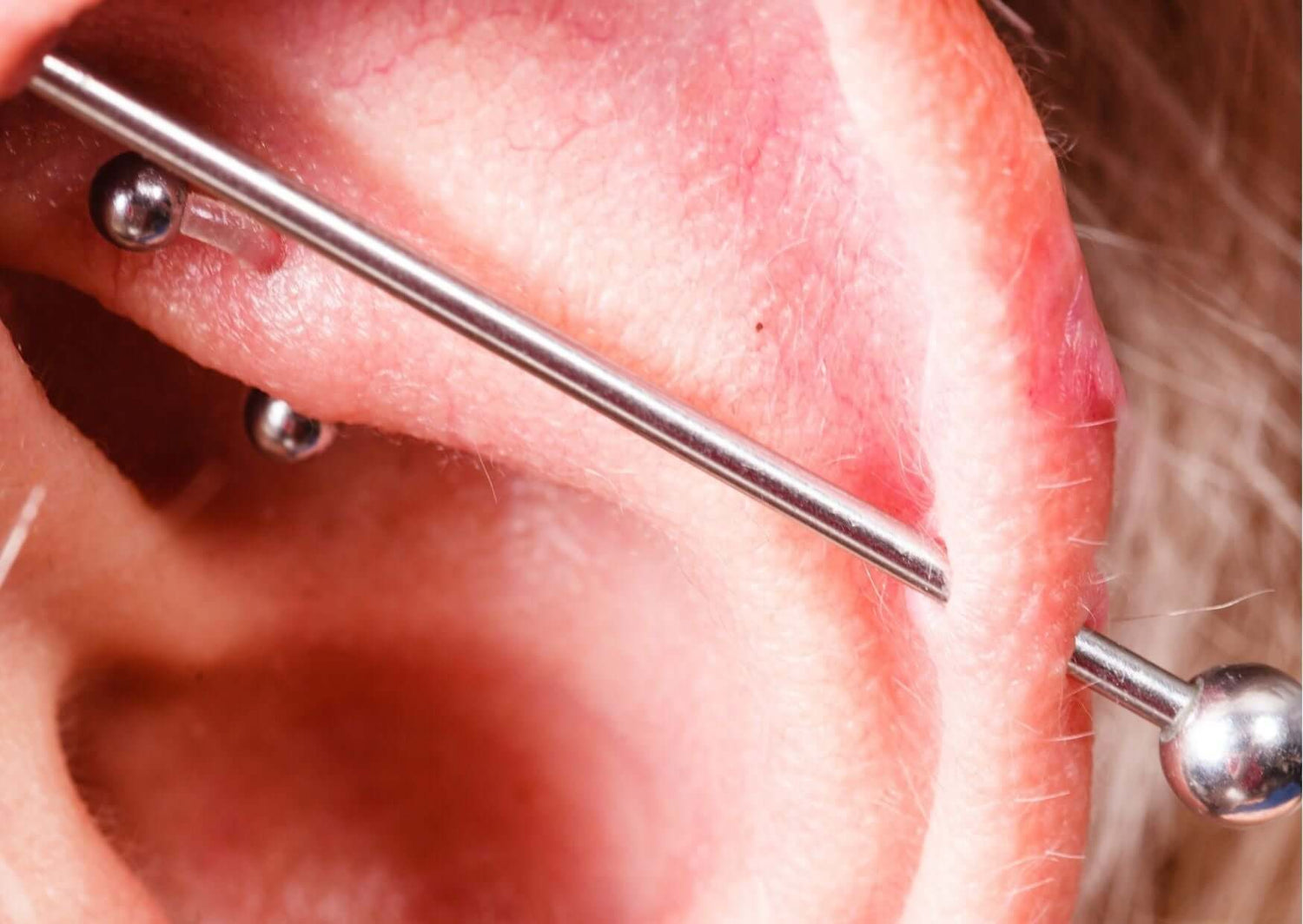 Is Your Industrial Piercing Infected? What to Do About It - Dr. Piercing Aftercare
