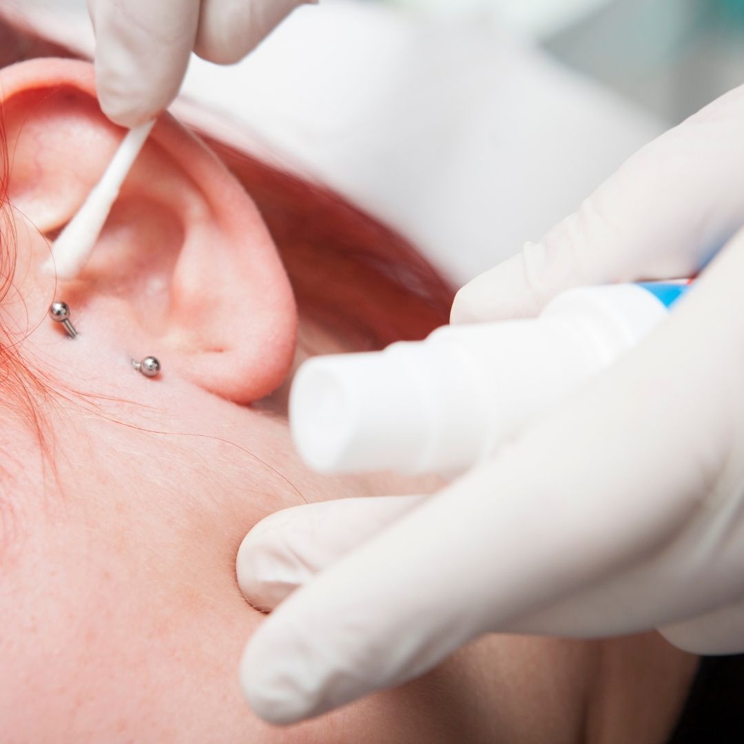 A person cleaning their new ear piercing with a saline solution to prevent scars and keloids, following proper aftercare procedures.
