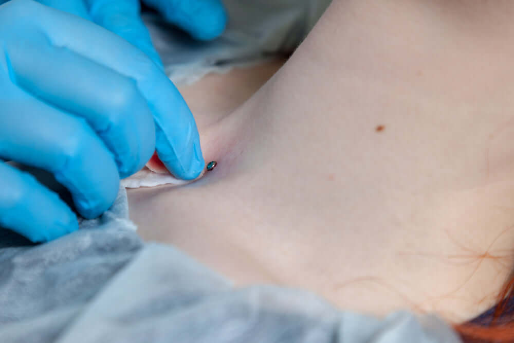 What is a Dermal Piercing? - Dr. Piercing Aftercare